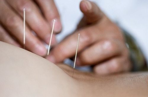 Akupunktura v redukci váhy
